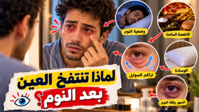 انتفاخ العين بعد النوم